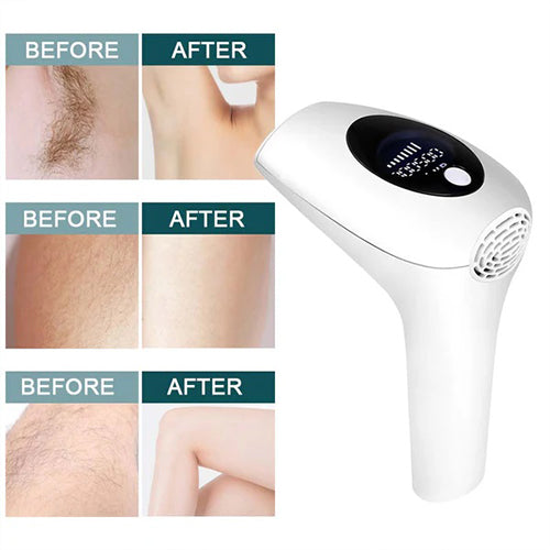 جهاز إزالة الشعر بتقنية IPL – AM001 | 36 واط | 999,999 نبضة | 8 مستويات